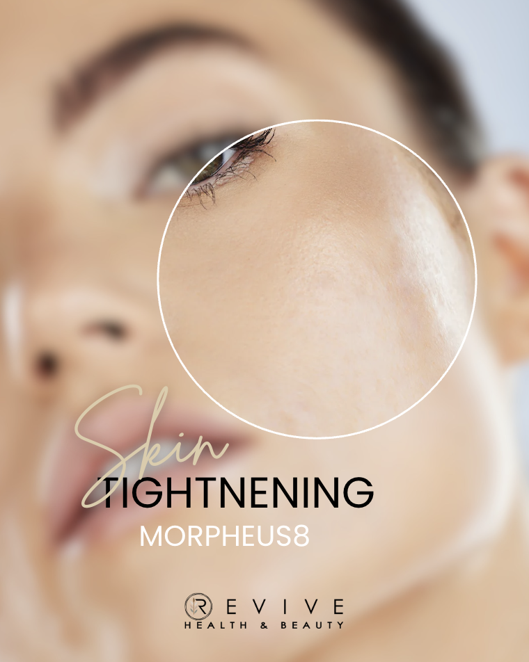 microneedling treatment