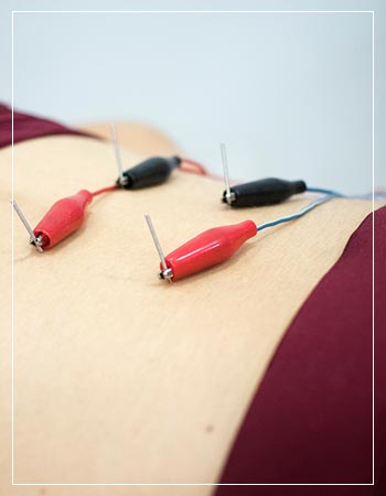 Dry Needling Near Me in Frisco, TX