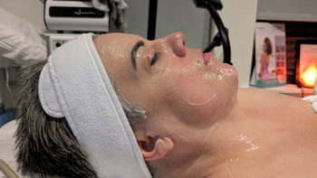 FORMA Treatment Before and After Photos of Revive Health and Beauty in Frisco, TX FORMA Treatment Before and After Photos of Revive Health and Beauty in Frisco, TX