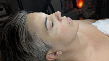 FORMA Treatment Before and After Photos of Revive Health and Beauty in Frisco, TX FORMA Treatment Before and After Photos of Revive Health and Beauty in Frisco, TX